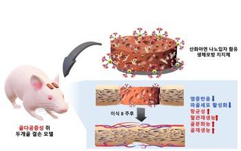 [사이언스] Development of a biomimetic scaffold that induces bone tissue regeneration : Patent News