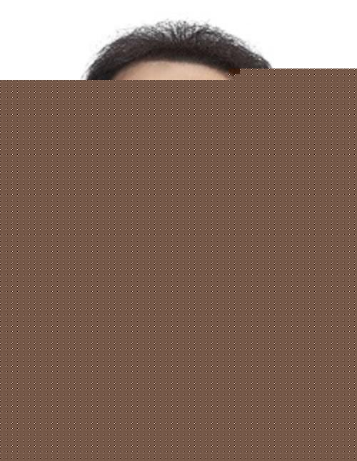 상계백병원 김창근 교수, 천식알러지 진단기술 미국 특허 등록 - 뉴스 썸네일 이미지